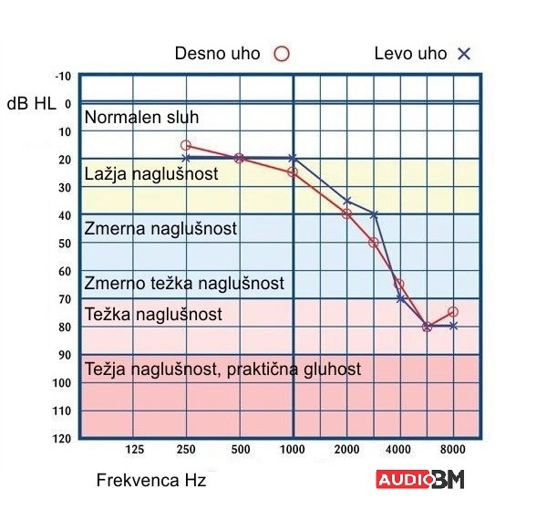 Brezplačen test sluha tonski avdiogram AUDIO BM slušni aparati