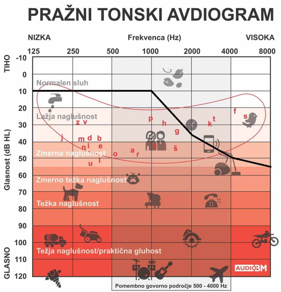 Ce-ne-slisimo-visokih vrekvenc-adg-tonski-avdiogram-audio-bm-svetovanje-slusni-aparati